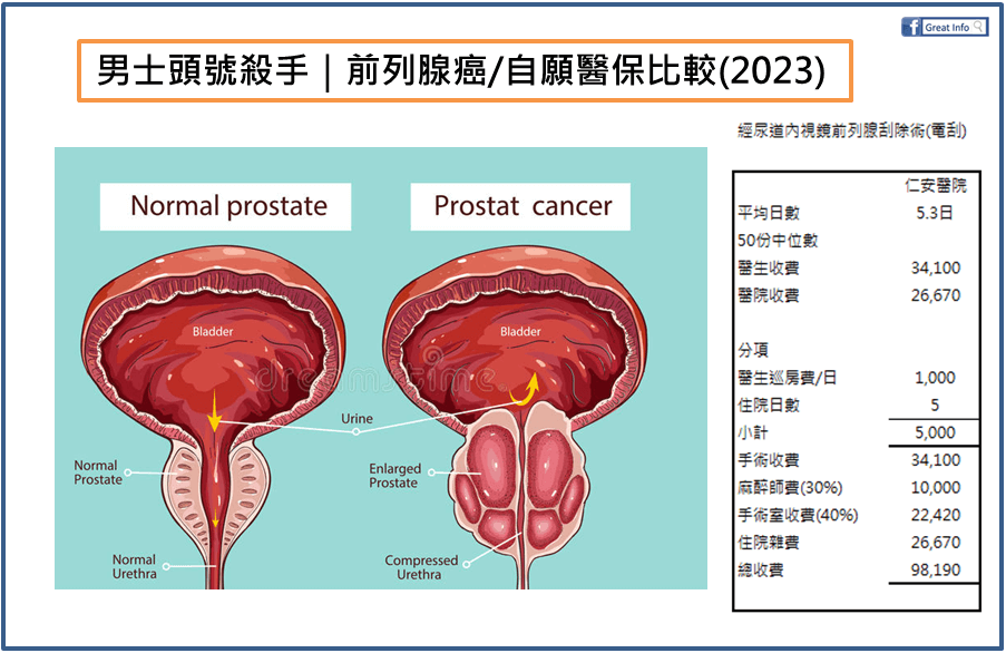 男士頭號殺手｜前列腺癌/自願醫保比較(2023)