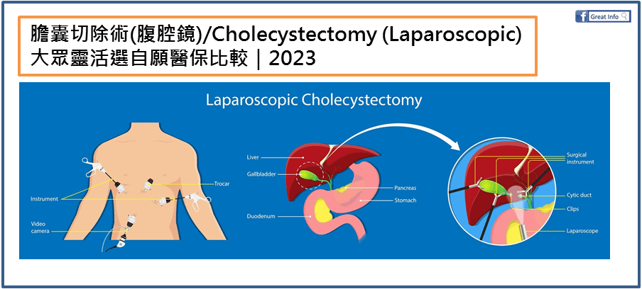 【膽囊切除術(腹腔鏡)】大眾自願醫保比較2023