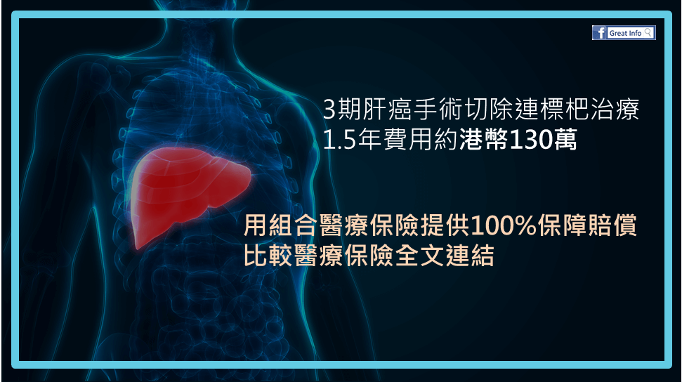 【1.5年肝癌治療費用】用組合醫保K.O. 130萬醫療費用￼