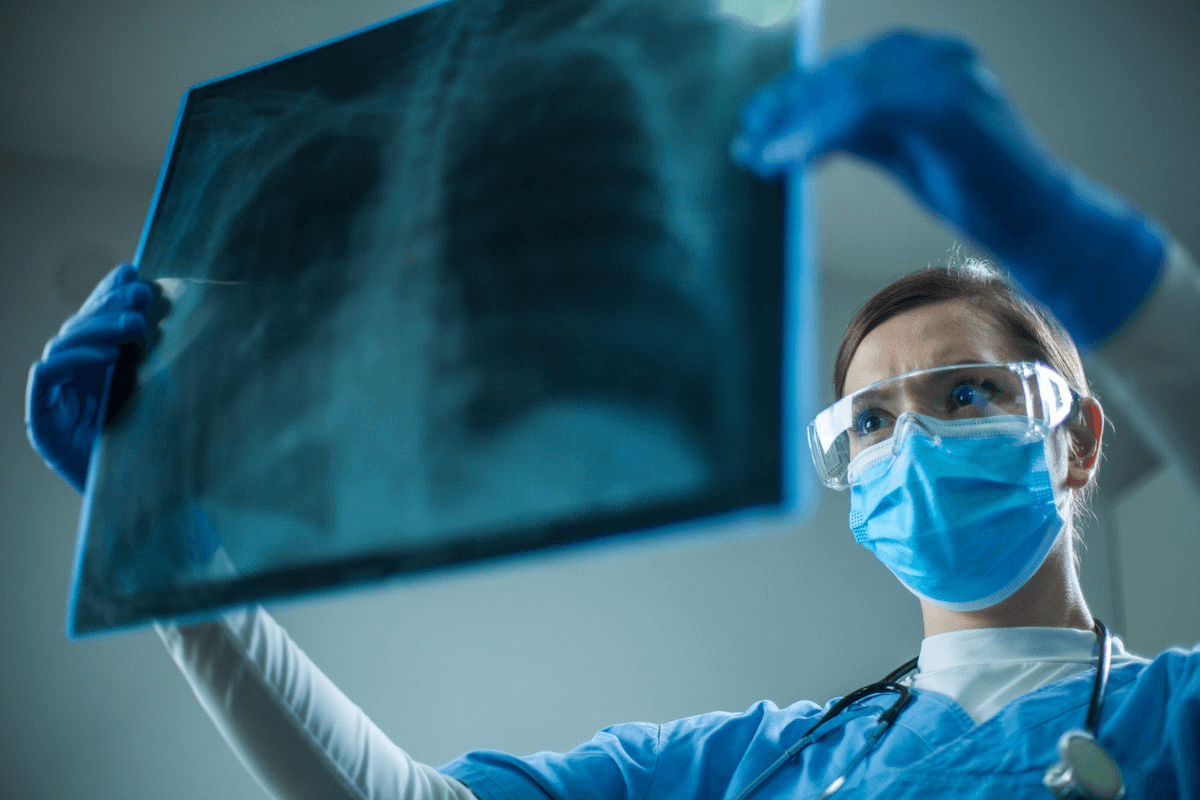 肺癌——手術治療